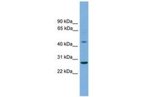 ZNF514 antibody  (C-Term)