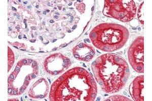 Human Kidney (formalin-fixed, paraffin-embedded) stained with ACE2at 2. (ACE2 anticorps  (N-Term))