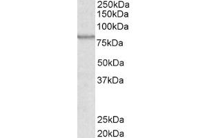 ABIN238622 (0. (ABCB5 anticorps  (Internal Region))