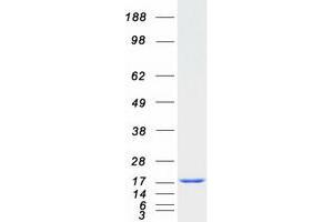Validation with Western Blot