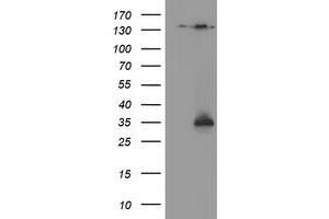 Western Blotting (WB) image for anti-NQO2 (NQO2) antibody (ABIN1499816) (NQO2 anticorps)
