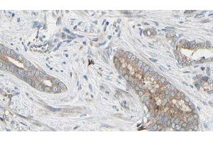 ABIN6276518 at 1/100 staining Human prostate tissue by IHC-P. (Glutathione Peroxidase 1 anticorps  (Internal Region))