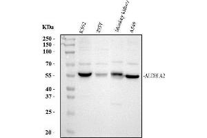 Western blot analysis of ALDH1A2 using anti-ALDH1A2 antibody (ABIN4886449). (ALDH1A2 anticorps  (AA 1-110))