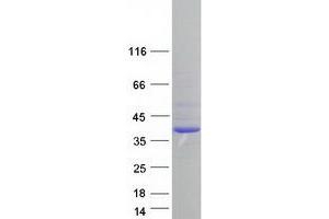 Validation with Western Blot