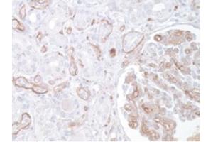 Image no. 1 for anti-Complement Component 3 (C3) antibody (ABIN951636) (C3 anticorps)