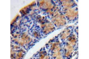 IHC-P analysis of Bowels tissue, with DAB staining. (TPSD1 anticorps  (AA 99-191))