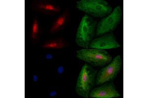 ABIN6259602 and ABIN6273527 staining  cells by IF/ICC.