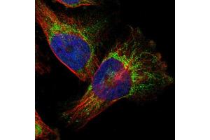 Immunofluorescent staining of U251 cells using TAOK3 polyclonal antibody  shows positivity in mitochondria (green). (TAO Kinase 3 anticorps  (AA 323-432))