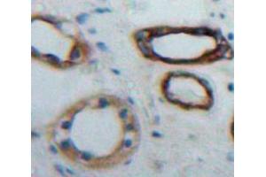 Used in DAB staining on fromalin fixed paraffin-embedded Kidney tissue