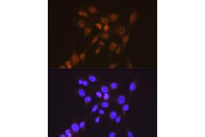 Immunofluorescence analysis of NIH-3T3 cells using [KO Validated] Smad2 Rabbit mAb (ABIN7270344) at dilution of 1:100 (40x lens). (SMAD2 anticorps)