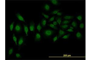 Immunofluorescence of monoclonal antibody to SFRS3 on HeLa cell.