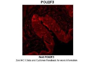 Sample Type :  Mouse tongue tissue  Primary Antibody Dilution :  1:100  Secondary Antibody :  Anti-rabbit-Cy3  Secondary Antibody Dilution :  1:500  Color/Signal Descriptions :  Red: POU2F3  Gene Name :  POU2F3  Submitted by :  Dr. (POU2F3 anticorps  (N-Term))
