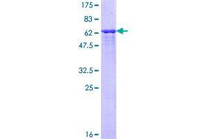 Image no. 1 for Adenosine Deaminase (ADA) (AA 1-363) protein (GST tag) (ABIN1305835)