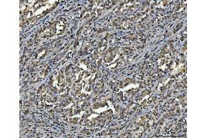 IHC analysis of hnRNP U/p120/HNRNPU using anti-hnRNP U/p120/HNRNPU antibody (ABIN7600979).