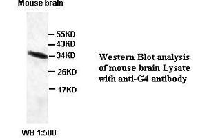 Image no. 1 for anti-Chromosome 6 Open Reading Frame 47 (C6ORF47) antibody (ABIN791190) (C6orf47 anticorps)