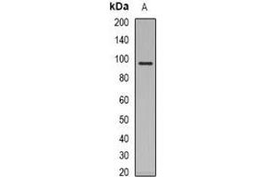 Western blot analysis of Glucocorticoid Receptor expression in Jurkat (A) whole cell lysates.