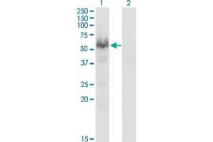 Western Blot analysis of PPP3CA expression in transfected 293T cell line by PPP3CA monoclonal antibody (M03), clone 2G8.
