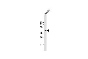 Anti-PRKACB Antibody (K29) at 1:1000 dilution + human brain lysate Lysates/proteins at 20 μg per lane. (PRKACB anticorps  (N-Term))