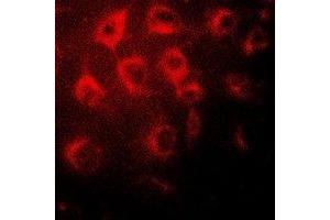 Immunofluorescent analysis of Wilms Tumor 1 staining in MCF7 cells. (WT1 anticorps)