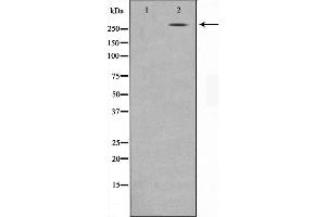 Western blot analysis on MDA-MB-435 cell lysate using NCoR1 Antibody,The lane on the left is treated with the antigen-specific peptide.