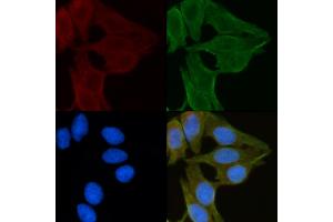 ABIN6260054 and ABIN6272249 staining Hela cells(30 min of UV treatment) by IF/ICC. (ARRDC1 anticorps  (C-Term))