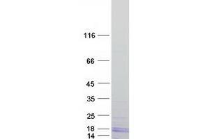 Validation with Western Blot