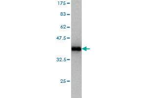 Western Blot detection against Immunogen (37. (CLP1 anticorps  (AA 316-425))