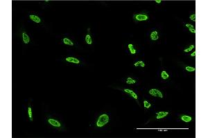 Immunofluorescence of monoclonal antibody to PKN1 on HeLa cell. (PKN1 anticorps  (AA 462-615))