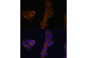 Immunofluorescence analysis of A-431 cells using RPL23A antibody (ABIN1682576, ABIN3018519, ABIN3018520 and ABIN6220494) at dilution of 1:100.