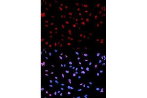 Immunofluorescence analysis of U2OS cells using Phospho-MEF2C-S396 antibody (ABIN5969920). (MEF2C anticorps  (pSer396))