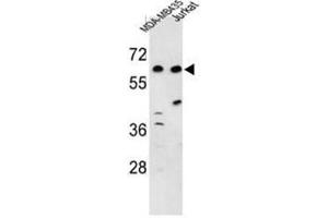 Western blot analysis of C19orf26 Antibody (Center) in MDA-MB435, Jurkat cell line lysates (35µg/lane). (C19orf26 anticorps  (Middle Region))