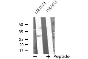 Western blot analysis of extracts from COLO205 cells, using MSX2 antibody. (Msx2/Hox8 anticorps  (Internal Region))