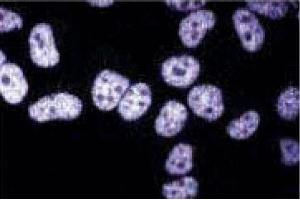 Immunofluorescent staining of HeLa cells.