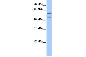 WB Suggested Anti-ZSCAN5C Antibody Titration:  0. (ZSCAN5C anticorps  (C-Term))