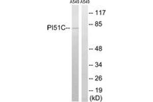 Western blot analysis of extracts from A549 cells, using PIP5K1C Antibody. (PIP5K1C anticorps  (AA 305-354))