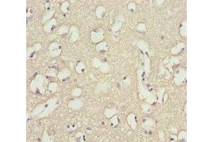 Immunohistochemistry of paraffin-embedded human brain tissue using ABIN7173958 at dilution of 1:100 (INPP4A anticorps  (AA 1-250))