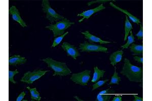 Immunofluorescence of monoclonal antibody to USP9X on HeLa cell. (USP9X anticorps  (AA 1-90))