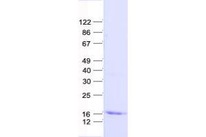 Validation with Western Blot