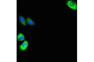 Immunofluorescent analysis of HepG2 cells using ABIN7144175 at dilution of 1:100 and Alexa Fluor 488-congugated AffiniPure Goat Anti-Rabbit IgG(H+L) (ASB1 anticorps  (AA 1-300))