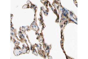 ABIN6266766 at 1/100 staining human lung tissue sections by IHC-P. (TNFAIP8 anticorps  (Internal Region))