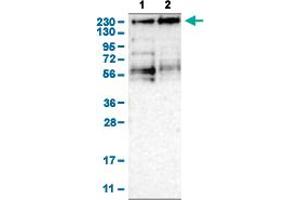 Western Blot analysis of (1) human cell line RT-4, and (2) human cell line U-251MG sp. (KDM3B anticorps  (AA 307-448))