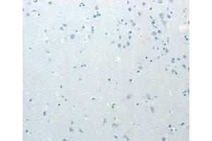 Immunohistochemistry (IHC) image for anti-Minichromosome Maintenance Deficient 4 (MCM4) antibody (ABIN1873665) (MCM4 anticorps)