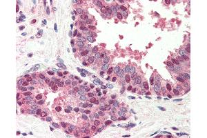 Anti-BIK antibody IHC of human prostate. (BIK anticorps  (N-Term))