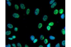 Immunofluorescent staining of SK-N-SH cells (Human neuroblastoma, ATCC HTB-11) (right). (PSIP1 anticorps  (AA 85-188))