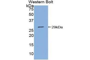 Western blot analysis of the recombinant protein. (PIAS1 anticorps  (AA 409-645))