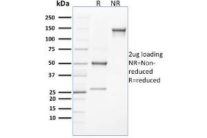 SDS-PAGE Analysis Purified CLEC9A Mouse Monoclonal Antibody (8F9). (CLEC9A anticorps)