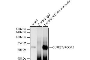 Immunoprecipitation analysis of 300 μg extracts of THP-1 cells using 3 μg CoREST/RCOR1 antibody (ABIN7269920).