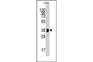 Image no. 1 for anti-Aldolase A, Fructose-Bisphosphate (ALDOA) (N-Term) antibody (ABIN357866)