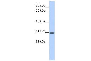 BCAS2 antibody used at 1 ug/ml to detect target protein.