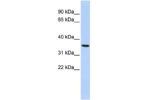 WB Suggested Anti-PAQR6 Antibody Titration:  0. (PAQR6 anticorps  (N-Term))
